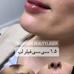 کلینیک لیزر و زیبایی مهسان