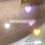کلینیک لیزر و زیبایی مهسان