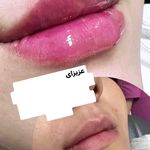 کلینیک لیزر و زیبایی مهسان