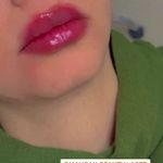 کلینیک لیزر و زیبایی مهسان