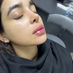 کلینیک لیزر و زیبایی مهسان