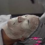 جوانسازی صورت و گردن
