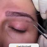 کلینیک پوست وزیبایی ومرکز تخصصی فیلربادی