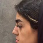 کلینیک پوست وزیبایی ومرکز تخصصی فیلربادی