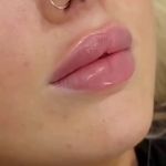 کلینیک پوست وزیبایی ومرکز تخصصی فیلربادی