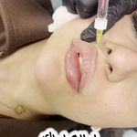 کلینیک پوست وزیبایی ومرکز تخصصی فیلربادی