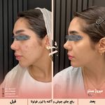 مرکز پزشکی و زیبایی میروژ سنتر