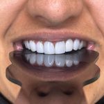 دندانپزشکی دکتر فاطمه محبوبی