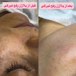 مرکز لیزر موهای زائد ماهور