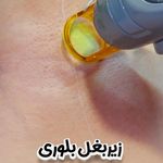 مرکز پوست و لیزر بلزا