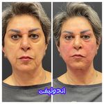 کلینیک پوست و مو بلانژ