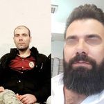 کلینیک تخصصی کاشت مو وابرو خبازی