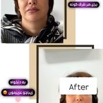 کلینیک پوست و مو و لیزر نیلوفر آبی