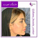 کلینیک زیبایی دیانا