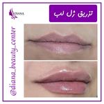 کلینیک زیبایی دیانا