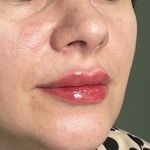 مطب پوست و زیبایی و لاغری دکتر صبرا مقدم