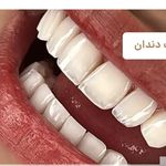 دندانساز میثم سیاوشی