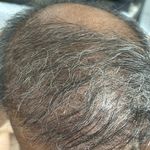مرکز تخصصی اسکالپ تراپی (عارفه باقری)