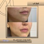مطب پوست مو زیبایی فردوس شرق