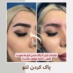 کلینیک زیبایی استاربیوتی