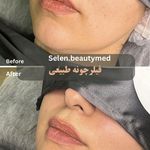 کلینیک زیبایی و لیزر سلن مشهد