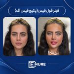 مرکز تخصصی زیبایی و جوانسازی دمور