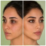 کلینیک زیبایی و لیزر لوتوس