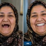 دندانسازی لبخند