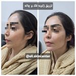 مطب زیبایی دکتر ملکی