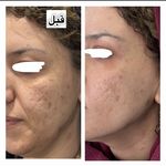 کلینیک زیبایی بلک ساوه