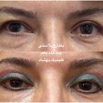 کلینیک تخصصی لیزر ،پوست و‌زیبایی بهشاد