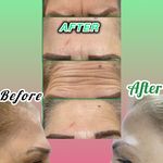 جوانسازی و زیبای فرشته