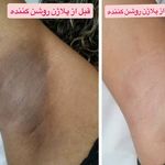 مرکز لیزر موهای زائد ماهور