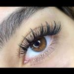 کاشت مژه پارسافر