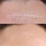خدمات تخصصی تتو و کاموفلاژ بانوان- تارا