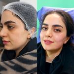 کلینیک زیبایی پارسیان آلفا