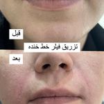 کلینیک پوست،مو،زیبایی،مرکز لیزر ‌پرنسا