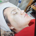 خدمات پاکسازی پوست غزال