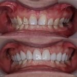 دنداپزشکی دکتر یاشار معزز