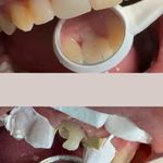 مطب دندانپزشک رویان دکتر کوثر قلی زاده