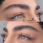 مرکز تخصصی فیبروز ابرو حانیه فراهانی