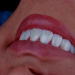 مطب دندانپزشکی زیبایی دکتر مانديس صدر