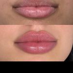 کلینیک زیبایی و لیزر لوتوس