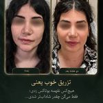 کلینیک زیبایی و مرکز لیزر موی زائد آیسا