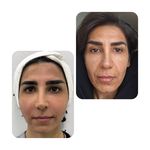 کلینیک پوست وزیبایی ومرکز تخصصی فیلربادی