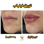 کلینیک زیبایی و مرکز لیزر هانیسا