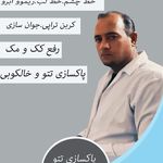 خدمات لیزر مستر تتو.