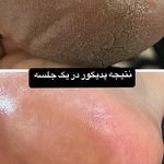 خدمات تخصصی کاشت ناخن سپیده طالبی