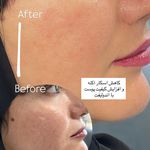 مرکز لیزر ،پوست و زیبایی کندی بیوتی