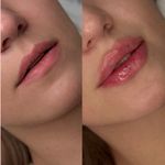 کلینیک پوست و زیبایی ژیلاوَش